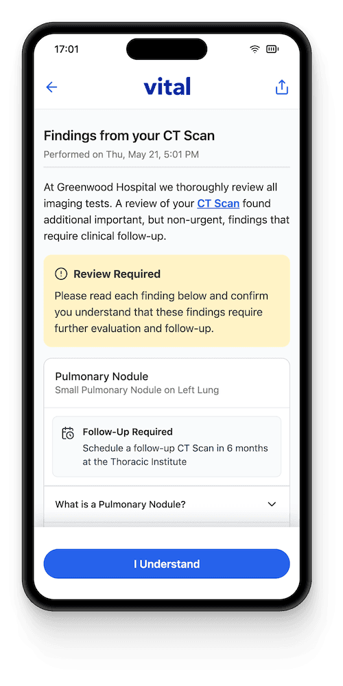 Vital Guard pulmonary nodule tracking